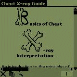 Basics of Chest X-ray Interpretation