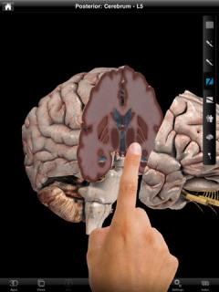 Brain Pro (NOVA Series) - iPad edition