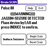 Brain SCAN
