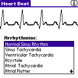 HeartBeat by Metaworks
