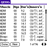 Quantitative EMG