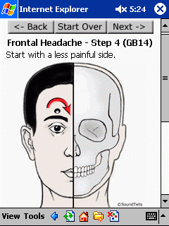 Headache Remedy from MobileReference - Acupressure Guide For Relieving Headaches and Migraines