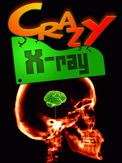 Crazy Xray