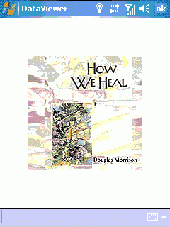 How we Heal - A Medical Guide by Douglas Morrison