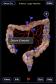 Digestive System - iPhone edition