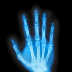 X-Ray Scanner PRO